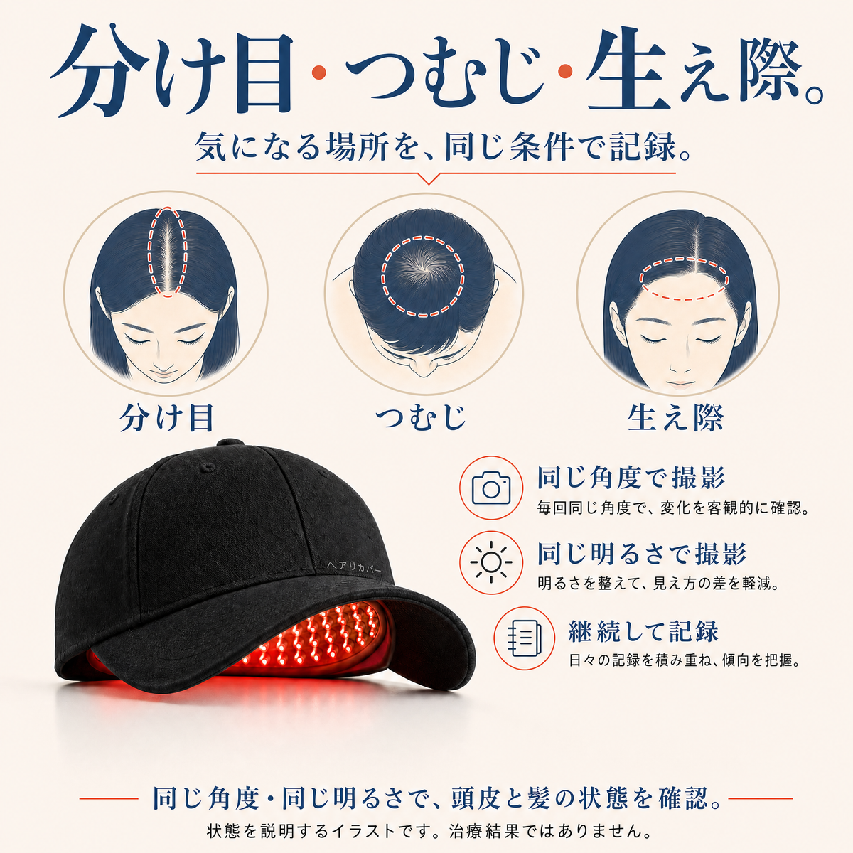 分け目・つむじ・生え際